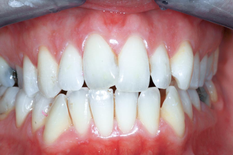 Estetica dentale | Studio dentistico Galassini