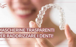 Mascherine trasparenti per raddrizzare i denti: una rivoluzione nel campo dell’ortodonzia