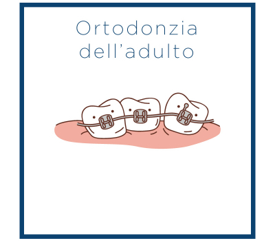 Ortodonzia Adulti Ortodonzia Adulti