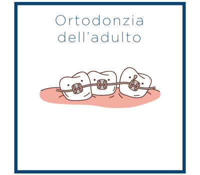 Ortodonzia Adulti