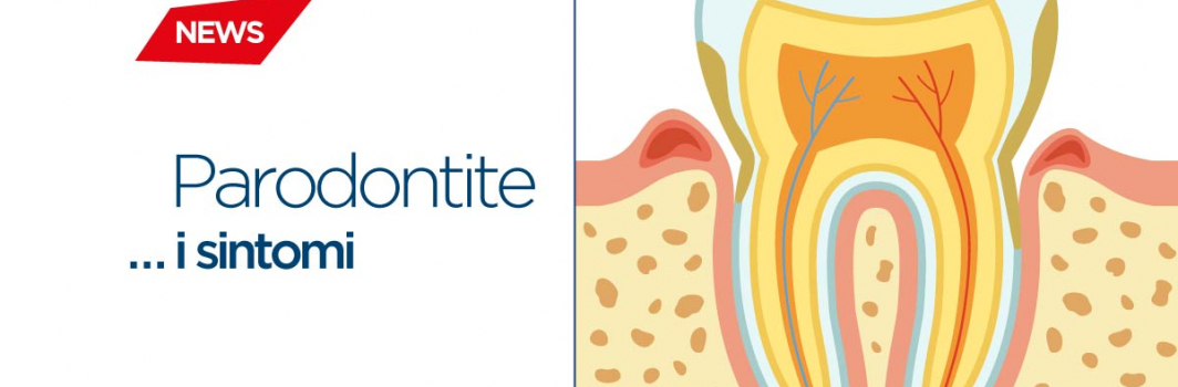 Parodontite: cause, sintomi e prevenzione