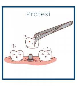 Protesi Protesi
